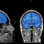 brain bet